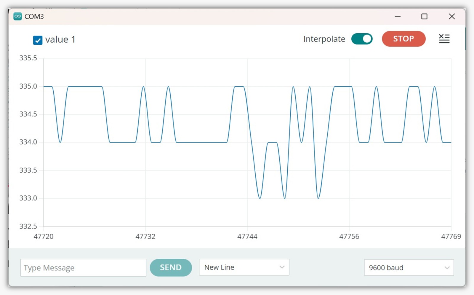 Le moniteur patient affichant un rythme sinusal normal, validant le bon fonctionnement du testeur ECG.