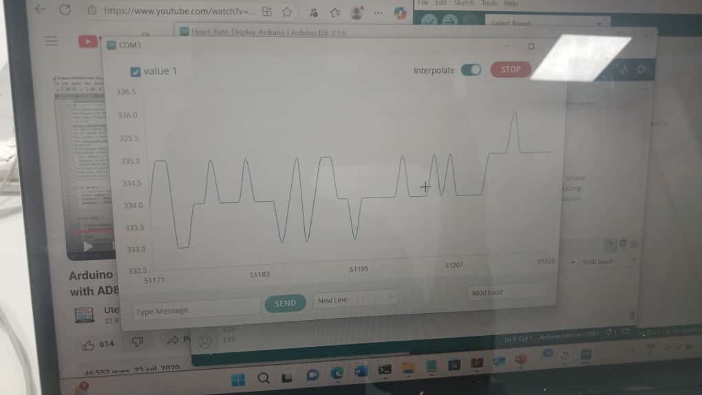 Gros plan sur l'écran du prototype affichant le signal ECG sinusal généré.