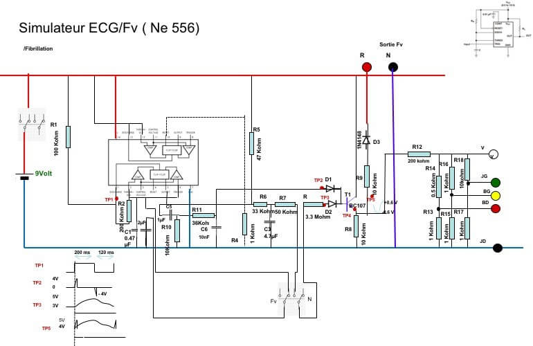 Prototype de testeur ECG basé sur Arduino avec écran LCD